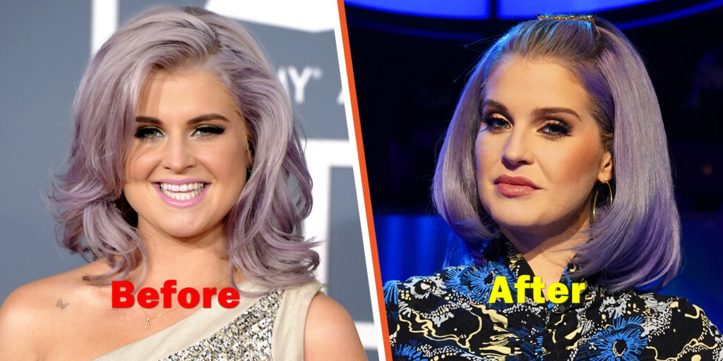 Kelly Osbourne Weight Loss Before and After